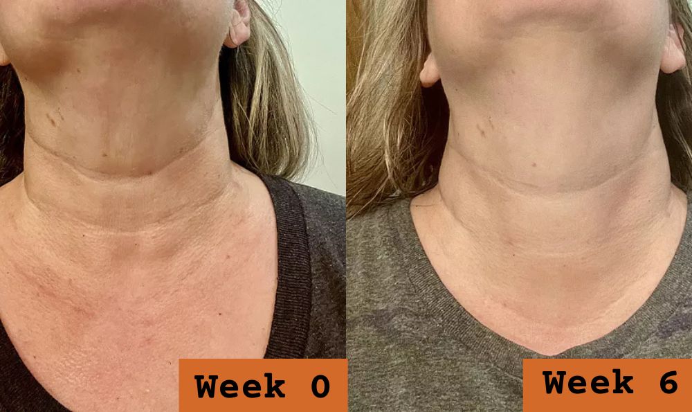 Before and after customer result