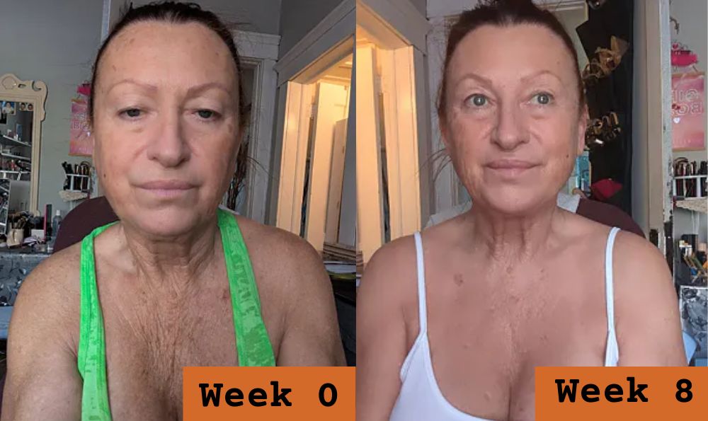 Before and after customer result