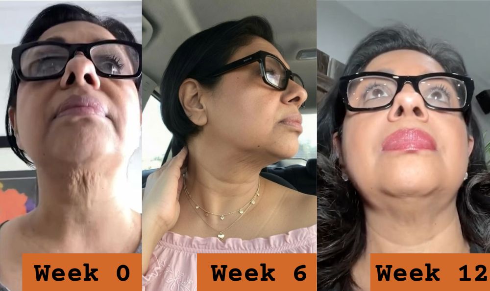 Before and after customer result