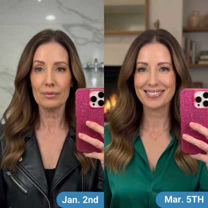 NeckProtocol Tight & Lift