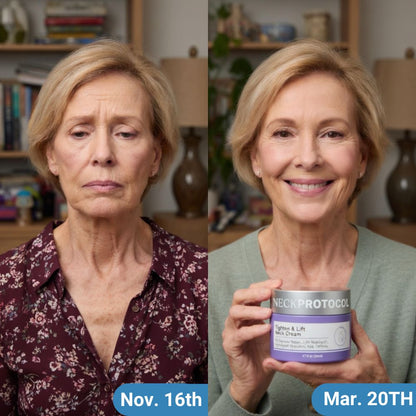 NeckProtocol Tight & Lift